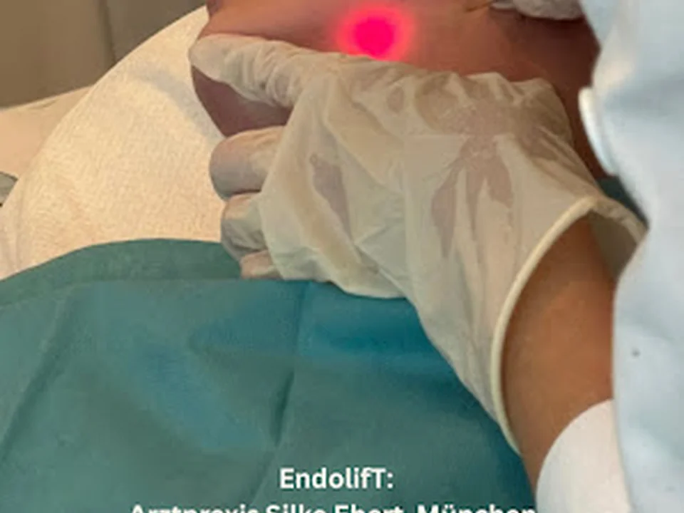 Arztpraxis Silke Ebert München, Endolift München, Radiesse, Ultherapy München, Morpheus8, Sculptra